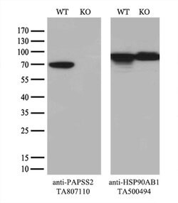 PAPSS2 Mouse anti-Human, Clone: OTI5H3, lyophilized, TrueMAB 100 &mu;g;