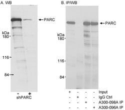 PARC/H7-AP1 Polyclonal Antibody, Bethyl Laboratories:Antibodies:Primary