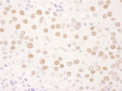 PARN Rabbit anti-Human, Mouse, Polyclonal, Bethyl Laboratories 100 &mu;L;