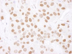 PARN Rabbit anti-Human, Mouse, Polyclonal, Bethyl Laboratories 100 &mu;L;