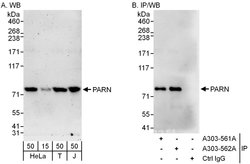 PARN Rabbit anti-Human, Mouse, Polyclonal, Bethyl Laboratories 100 &mu;L;