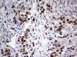 PARN Monoclonal Antibody (OTI1G5), TrueMAB , OriGene 100 &mu;L; Unconjugated:Antibodies,