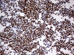 PARN Monoclonal Antibody (OTI1G5), TrueMAB , OriGene 100 &mu;L; Unconjugated:Antibodies,