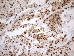 PARN Mouse anti-Human, Clone: UMAB143, liquid, UltraMAB 100 &mu;L; Unconjugated:Antibodies,