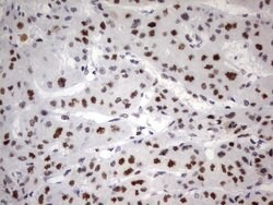 PARN Mouse anti-Human, Clone: UMAB143, liquid, UltraMAB 100 &mu;L; Unconjugated:Antibodies,