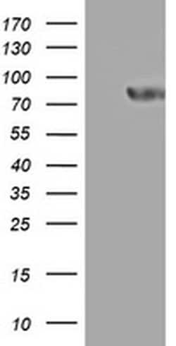 PARN Monoclonal Antibody (OTI4D6), TrueMAB , OriGene:Antibodies:Primary