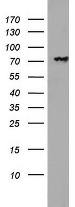 PARN Monoclonal Antibody (OTI1G5), TrueMAB , OriGene:Antibodies:Primary