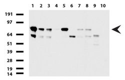 PARN Mouse anti-Human, Clone: UMAB143, liquid, UltraMAB 100 &mu;L; Unconjugated:Antibodies,