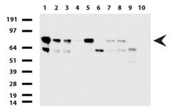 PARN Mouse anti-Human, Clone: UMAB143, lyophilized, UltraMAB 100 &mu;g;