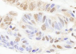 PARP1 Polyclonal Antibody, Bethyl Laboratories 100 &mu;L; Unconjugated:Antibodies,