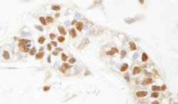 PARP1 Polyclonal Antibody, Bethyl Laboratories 100 &mu;L; Unconjugated:Antibodies,