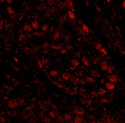 PARP1 Polyclonal Antibody, Bethyl Laboratories 100 &mu;L; Unconjugated:Antibodies,