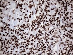 PARP1 Monoclonal Antibody (OTI5F1), TrueMAB , OriGene 30 &mu;L; Unconjugated:Antibodies,