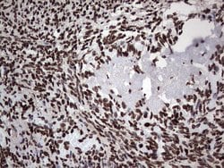 PARP1 Monoclonal Antibody (OTI5F1), TrueMAB , OriGene 30 &mu;L; Unconjugated:Antibodies,