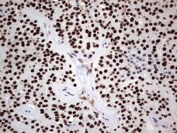 PARP1 Monoclonal Antibody (OTI5F1), TrueMAB , OriGene 30 &mu;L; Unconjugated:Antibodies,