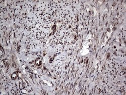 PARP1 Monoclonal Antibody (OTI5F1), TrueMAB , OriGene 30 &mu;L; Unconjugated:Antibodies,