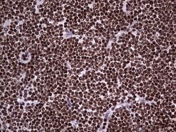 PARP1 Monoclonal Antibody (OTI5F1), TrueMAB , OriGene 30 &mu;L; Unconjugated:Antibodies,