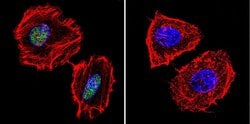 Invitrogen PARP1 Monoclonal Antibody (C-2-10) 50 &mu;L; Unconjugated:Antibodies,