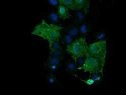 PARVA Monoclonal Antibody (OTI3G9), TrueMAB , OriGene 100 &mu;L; Unconjugated:Antibodies,