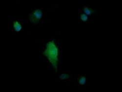 PARVA Monoclonal Antibody (OTI2B11), TrueMAB , OriGene 100 &mu;L; Unconjugated:Antibodies,