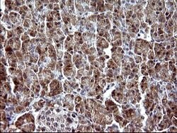 PARVA Monoclonal Antibody (OTI1C10), TrueMAB , OriGene 100 &mu;L; Unconjugated:Antibodies,
