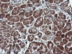 PARVA Monoclonal Antibody (OTI3H2), TrueMAB , OriGene 100 &mu;L | Buy Online | Origene Technologies | Fisher Scientific