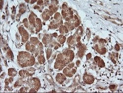 PARVA Monoclonal Antibody (OTI3H9), TrueMAB , OriGene 100 &mu;L; Unconjugated:Antibodies,