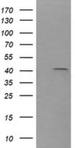 PARVA Mouse anti-Canine, Human, Mouse, Clone: OTI2F10, lyophilized, TrueMAB