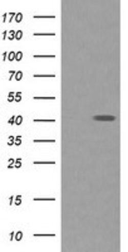 PARVA Mouse anti-Canine, Human, Mouse, Rat, Clone: OTI3H2, lyophilized,
