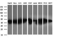 PARVA Monoclonal Antibody (OTI3H2), TrueMAB , OriGene 100 &mu;L | Buy Online | Origene Technologies | Fisher Scientific