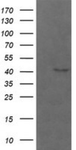 PARVA Mouse anti-Human, Mouse, Rat, Clone: OTI2B11, lyophilized, TrueMAB