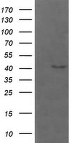 PARVA Monoclonal Antibody (OTI2B11), TrueMAB , OriGene 100 &mu;L; Unconjugated:Antibodies,
