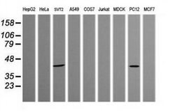 PARVA Monoclonal Antibody (OTI2B11), TrueMAB , OriGene 100 &mu;L; Unconjugated:Antibodies,