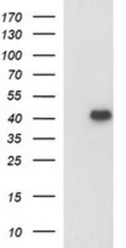 PARVA Mouse anti-Human, Clone: OTI2F9, lyophilized, TrueMAB 100 &mu;g;