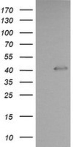 PARVA Mouse anti-Human, Mouse, Rat, Clone: OTI3H9, lyophilized, TrueMAB