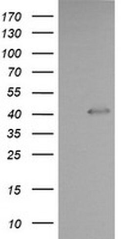 PARVA Monoclonal Antibody (OTI3H9), TrueMAB , OriGene 100 &mu;L; Unconjugated:Antibodies,
