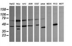 PARVA Monoclonal Antibody (OTI3H9), TrueMAB , OriGene 100 &mu;L; Unconjugated:Antibodies,