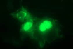 PARVB Mouse anti-Human, Clone: OTI1B9, lyophilized, TrueMAB 100 &mu;g;