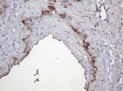 PARVB Monoclonal Antibody (OTI2H1), TrueMAB , OriGene 100 &mu;L; Unconjugated:Antibodies,