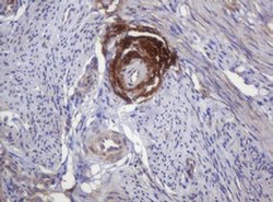 PARVB Monoclonal Antibody (OTI2H1), TrueMAB , OriGene 100 &mu;L; Unconjugated:Antibodies,