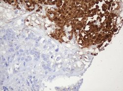 PARVB Monoclonal Antibody (OTI2H1), TrueMAB , OriGene 100 &mu;L; Unconjugated:Antibodies,
