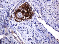 PARVB Monoclonal Antibody (OTI2H9), TrueMAB , OriGene 100 &mu;L; Unconjugated:Antibodies,