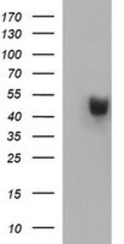 PARVB Mouse anti-Human, Clone: OTI1B9, lyophilized, TrueMAB 100 &mu;g;