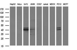 PARVB Mouse anti-Human, Clone: OTI1B9, lyophilized, TrueMAB 100 &mu;g;