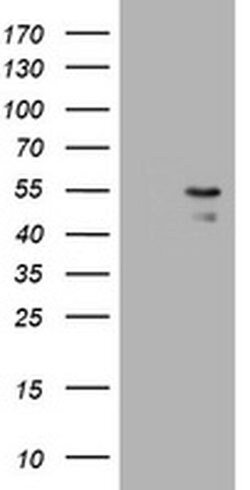PARVB Monoclonal Antibody (OTI2H9), TrueMAB , OriGene 100 &mu;L; Unconjugated:Antibodies,