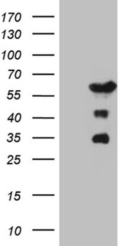 PATZ1 Mouse anti-Human, Clone: OTI2H4, lyophilized, TrueMAB 100 &mu;g;