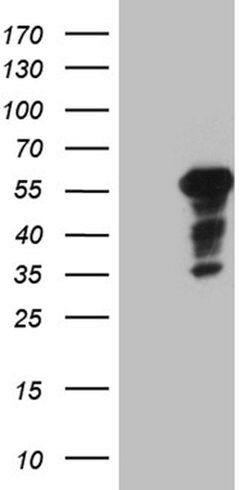 PATZ1 Monoclonal Antibody (OTI2D2), TrueMAB , OriGene 100 &mu;L; Unconjugated:Antibodies,