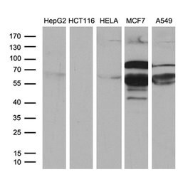 PATZ1 Monoclonal Antibody (OTI2D2), TrueMAB , OriGene 100 &mu;L; Unconjugated:Antibodies,