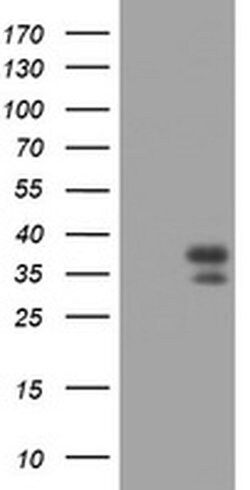 PAX4 Monoclonal Antibody (OTI6H4), TrueMAB , OriGene:Antibodies:Primary