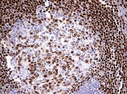 PAX5 Monoclonal Antibody (OTI6B6), TrueMAB , OriGene 100 &mu;L; Unconjugated:Antibodies,